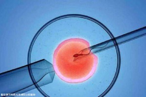 液氮存储